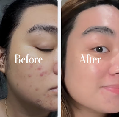 Before and after review 3