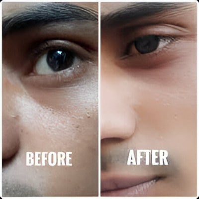 Before and after review 1